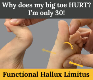 Functional Hallux Limitus - Link