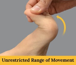 Functional Hallux Limitus - Non-weightbearing Range of Movement